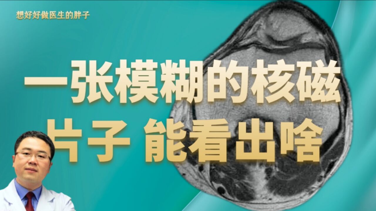 为什么医生喜欢看本院的核磁检查?咱们从一张模糊的检查片子谈起