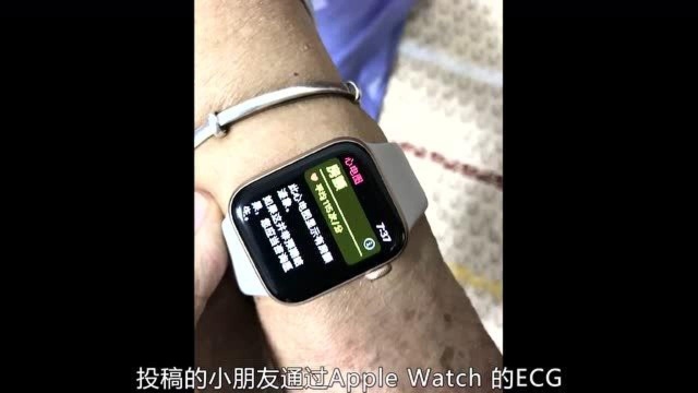 关键时刻智能手表真能救命!真人真事表明ECG功能不容忽视