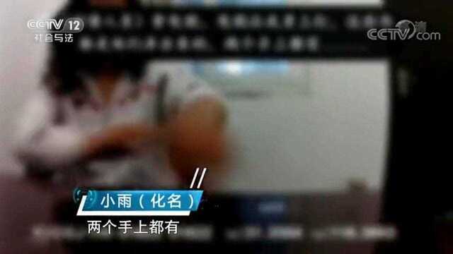 讨账公司太恶劣,女子被整害怕了,下体都是伤!