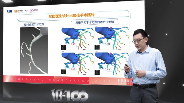 AI+手术机器人,睿心医疗如何为医生提供超越极限的脑、眼、手?