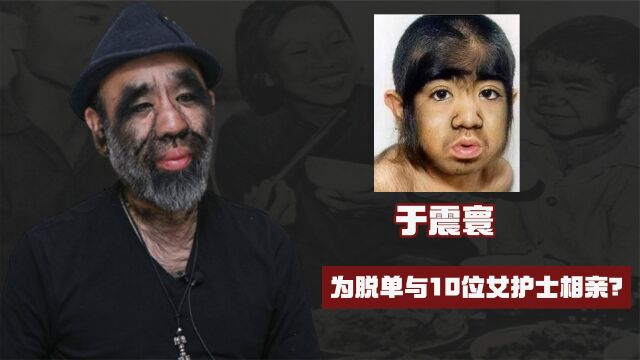 中国第一毛孩于震寰:为脱单与10位女护士相亲,如今怎么样了?