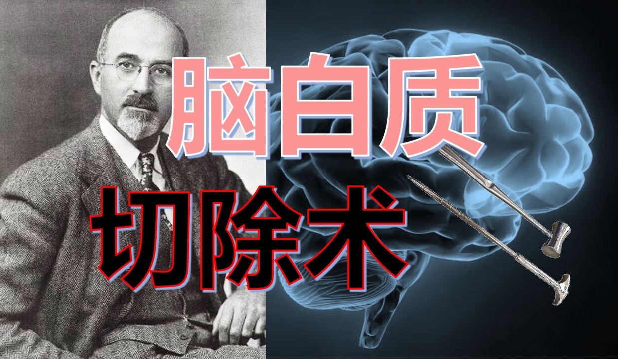 【科学八卦史】一个精神病医生是怎么酿成近代最大医学惨剧的