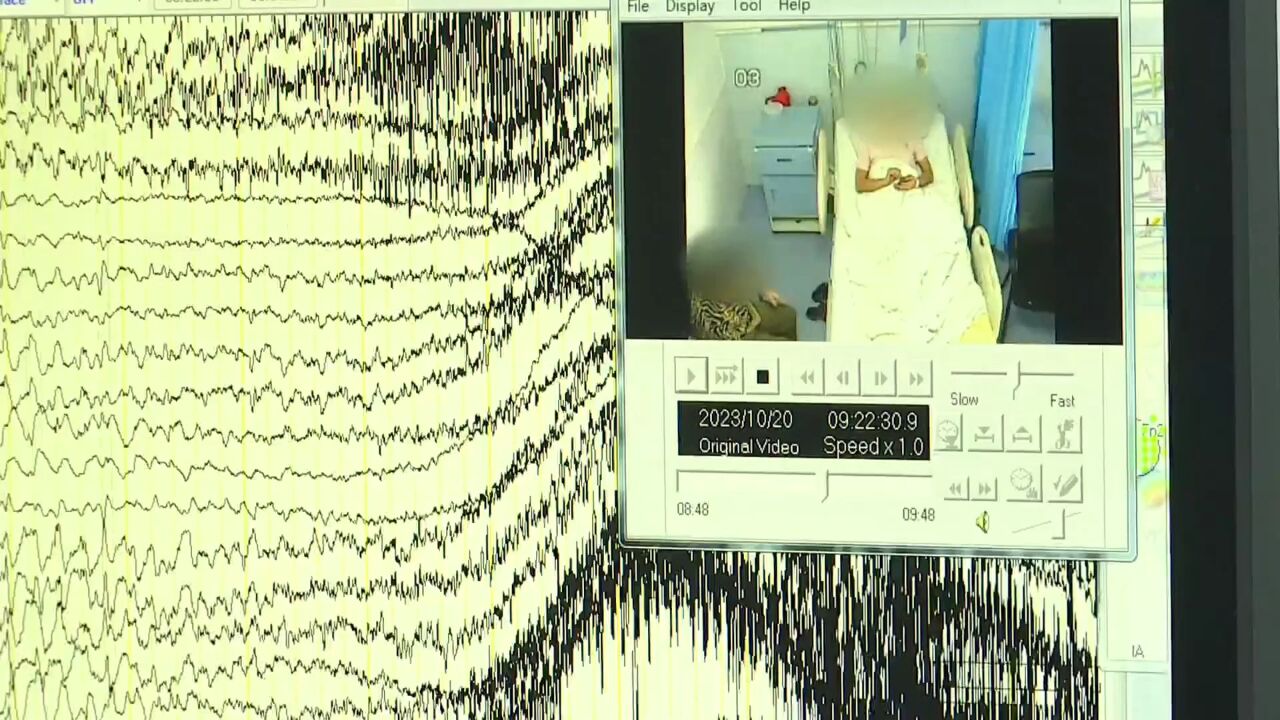 男子患难治性癫痫 医生用上“电子药”