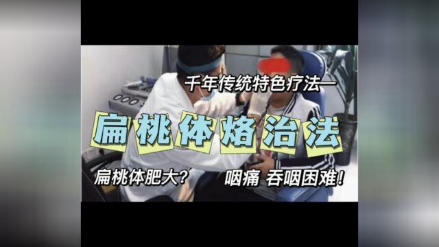 千年特色疗法扁桃体烙治法