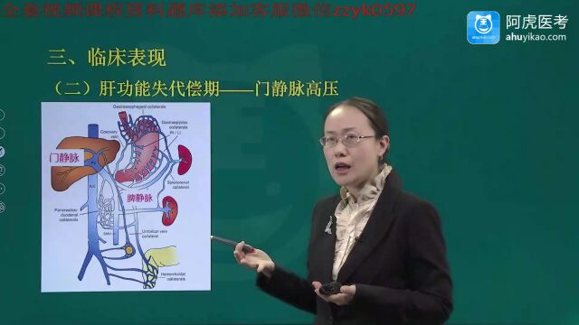 2023年阿虎医考内科护理学副高考试考点大纲押题讲座 肝硬化(1)