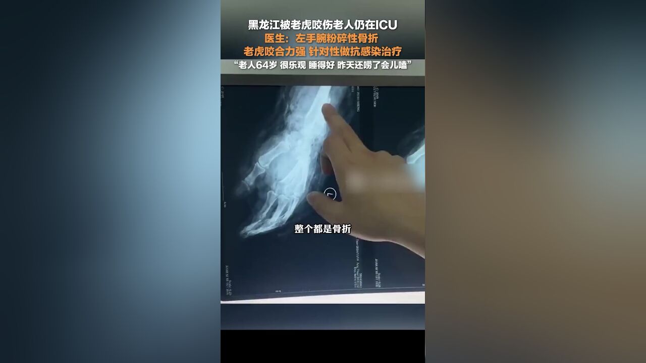 被老虎咬伤老人仍在ICU:主要做抗感染治疗,老人睡得好,昨天还唠了会儿嗑