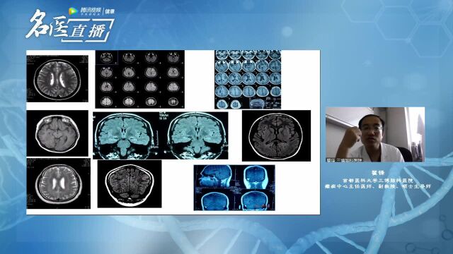 《名医大讲堂》639期 翟锋 药物难治性癫痫的术前评估及外科治疗