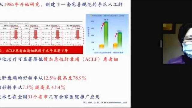 李兰娟:人工肝血液净化可治新冠危重症