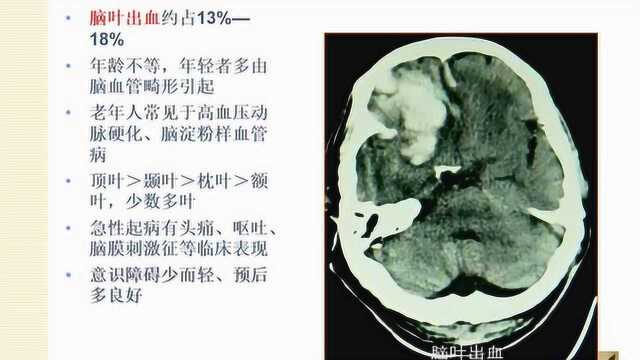 PBL教学法在护理查房中的应用