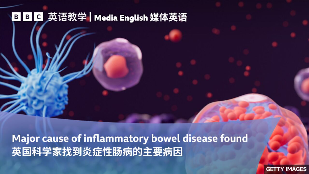 BBC媒体英语:英国科学家找到炎症性肠病的主要病因