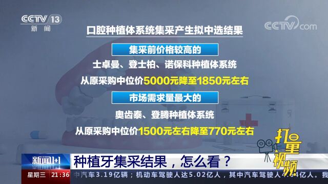 平均降价55%!专家:口腔种植体系统集采相当成功