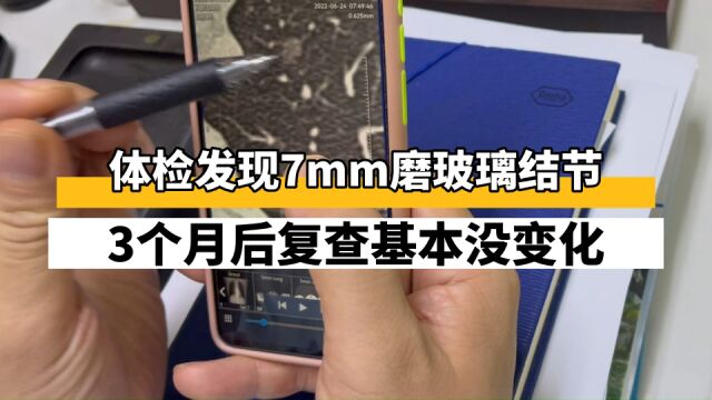 体检查出7mm肺磨玻璃结节,3个月复查没变化,可继续观察