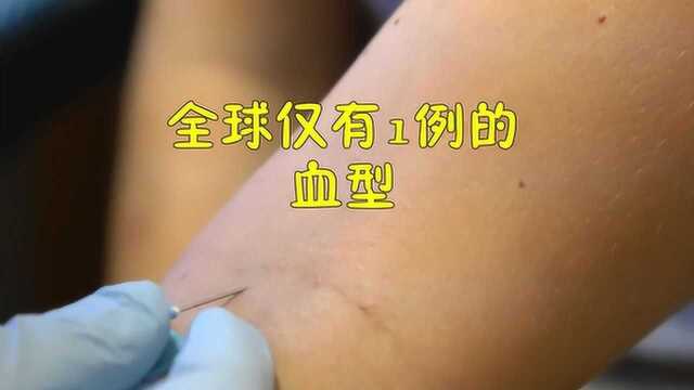 中国最罕见的血型在江苏出现,已被国际基因库收录,全球仅此一例