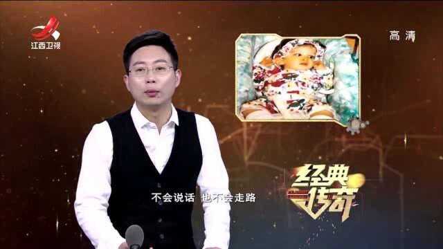 怪病解码4:18岁“不老女婴”,一直停留在6个月时的模样