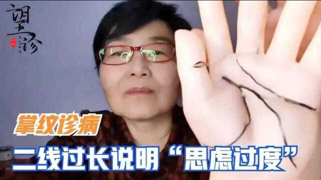 掌纹诊病:手上这条线过长说明“思虑过度”看看你有没有