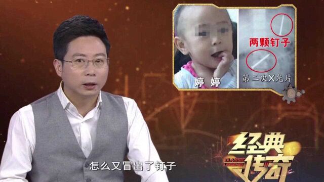 经典传奇:1岁孩子体内藏大量“钉子”,身体安然无恙,凶手成迷