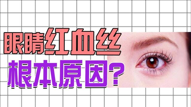 眼睛有红血丝?根本原因找到了,孟老师教你1个办法,改善红血丝