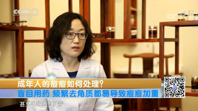 脸上长痘痘该如何处理?专家给出正确做法→