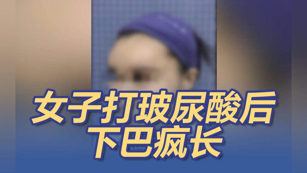 北京一女子打玻尿酸后下巴疯狂生长 又长又歪