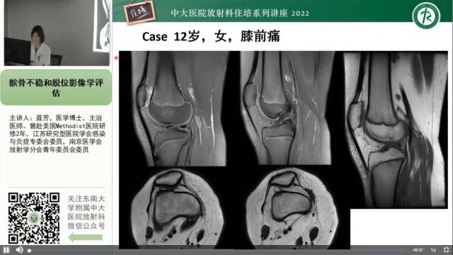 髌骨不稳和脱位影像学评估中大聂芳