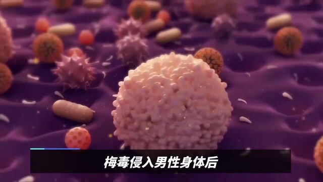 乌鲁木齐南湖医院口碑好吗【守护健康】男性得梅毒有什么症状