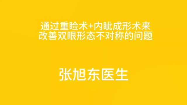 通过重睑术+内眦成形术来改善双眼形态不对称的问题【张旭东医生】