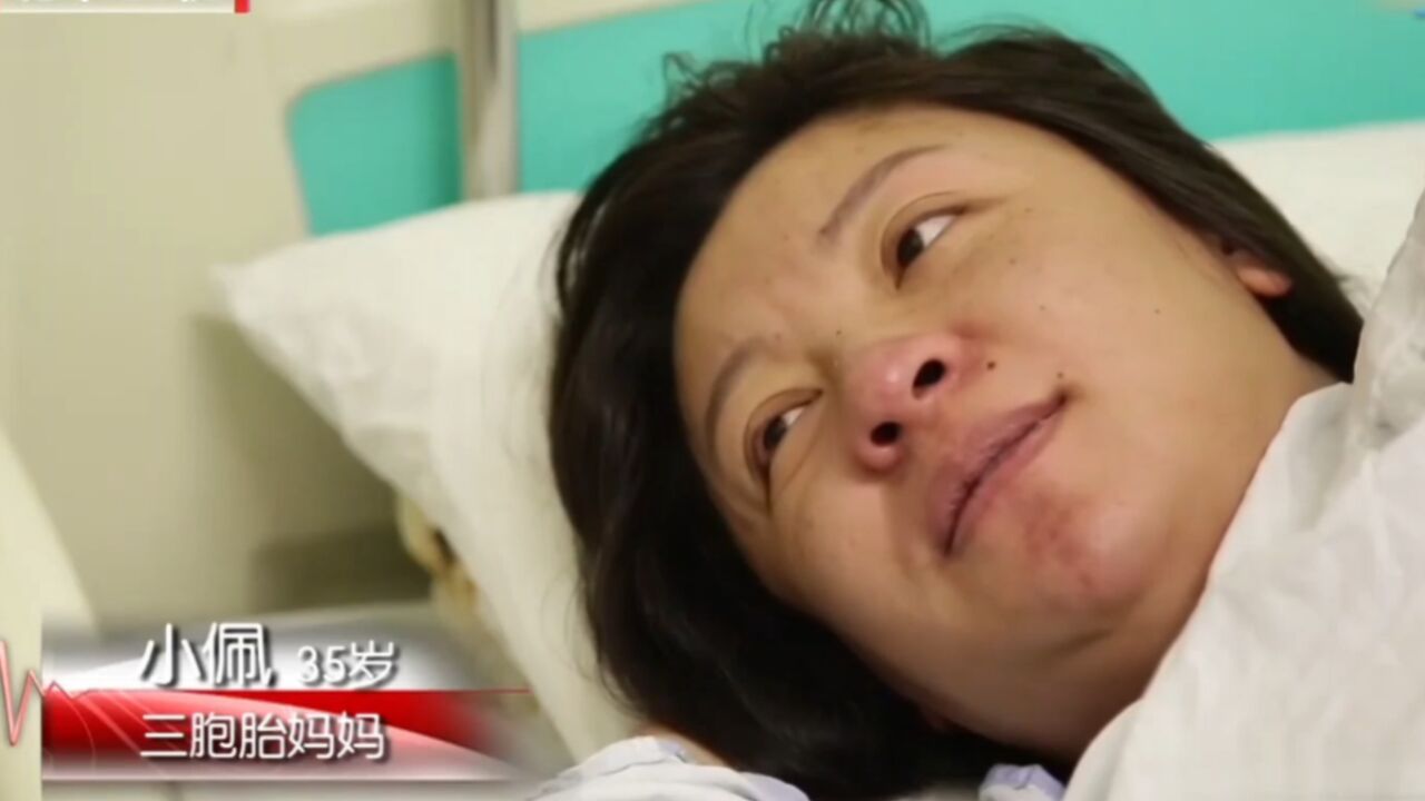 孕妈深夜突然破水,3胞胎紧急迫降,剖腹产手术迫在眉睫