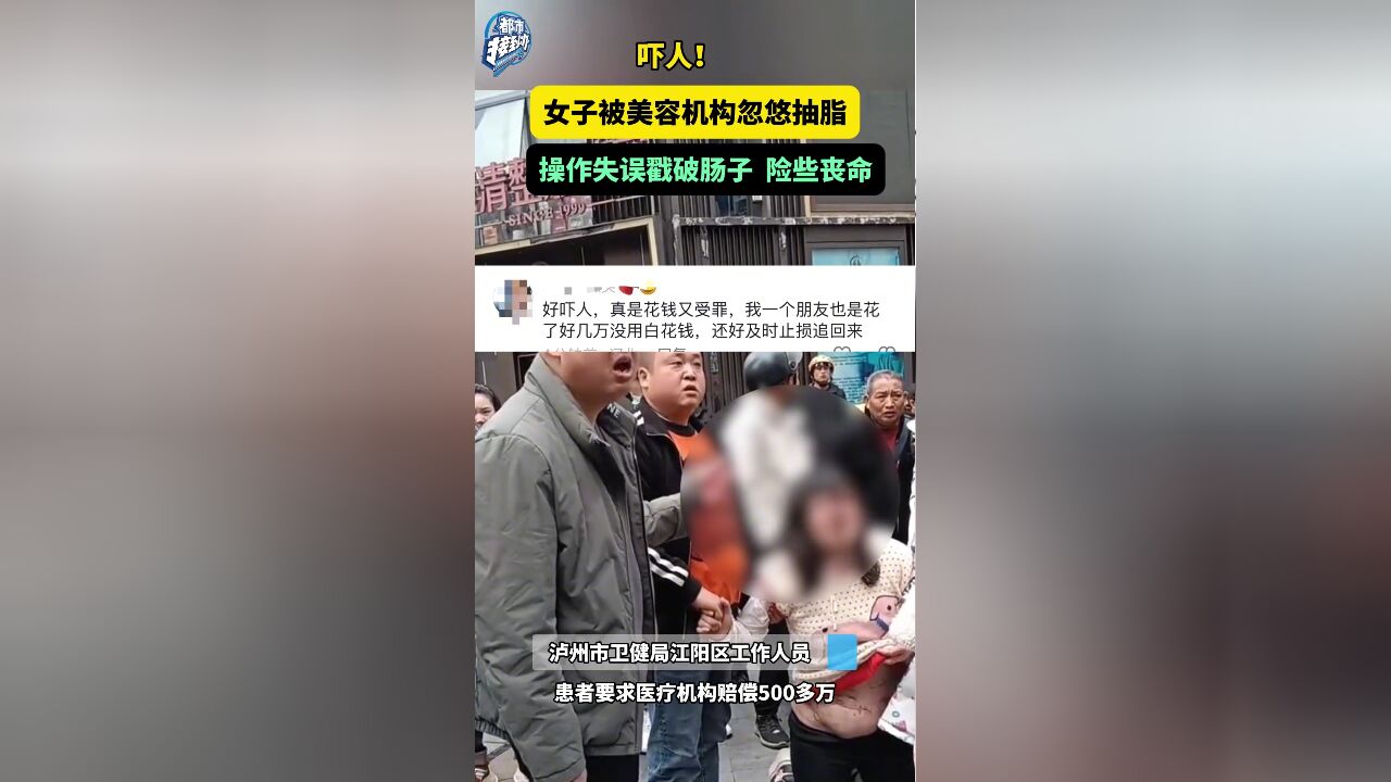 女子被美容机构忽悠抽脂 操作失误戳破肠子 险些丧命!