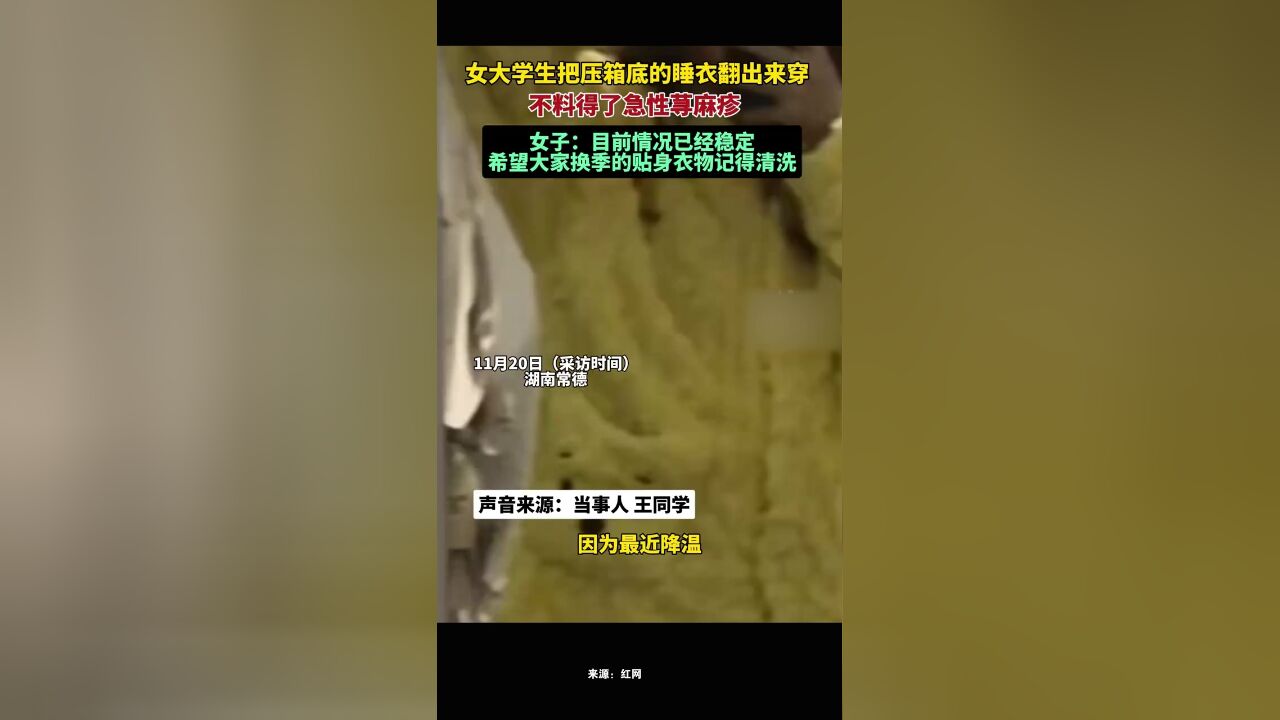 女大学生把压箱底的睡衣翻出来穿,不料得了急性荨麻疹