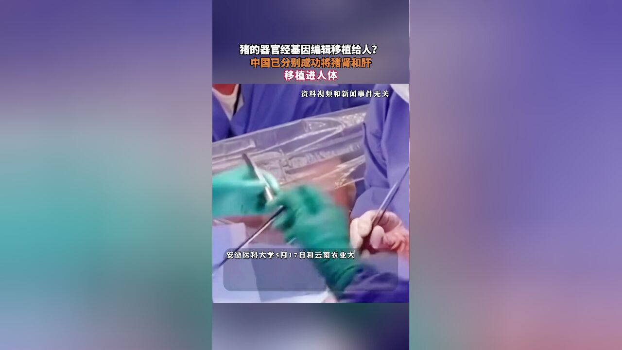 猪的器官经基因编辑移植给人?中国已分别成功将猪肾和肝,移植进人体