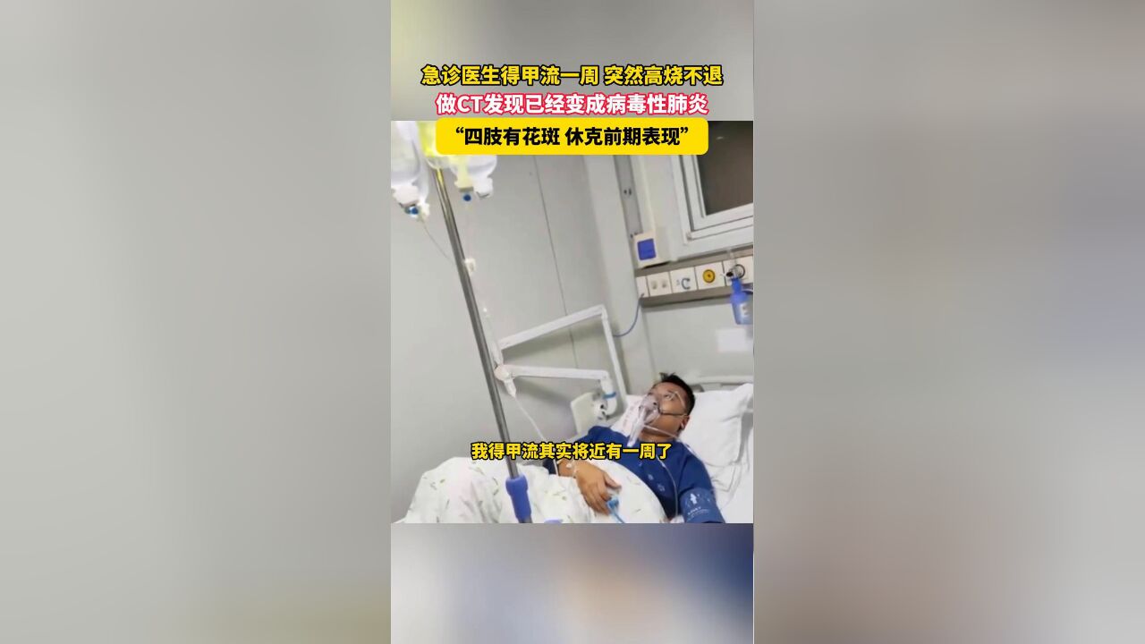 急诊医生得甲流一周 突然高烧不退,做CT发现已变成病毒性肺炎