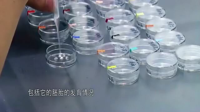 实拍试管婴儿时取卵和人工授精全过程,把精子摁住强行受精