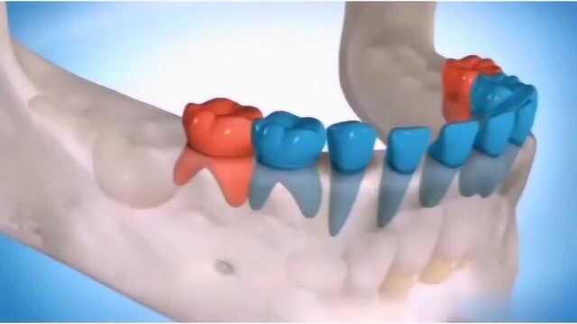 3D演示儿童换牙过程,让大家近距离感受换牙过程!