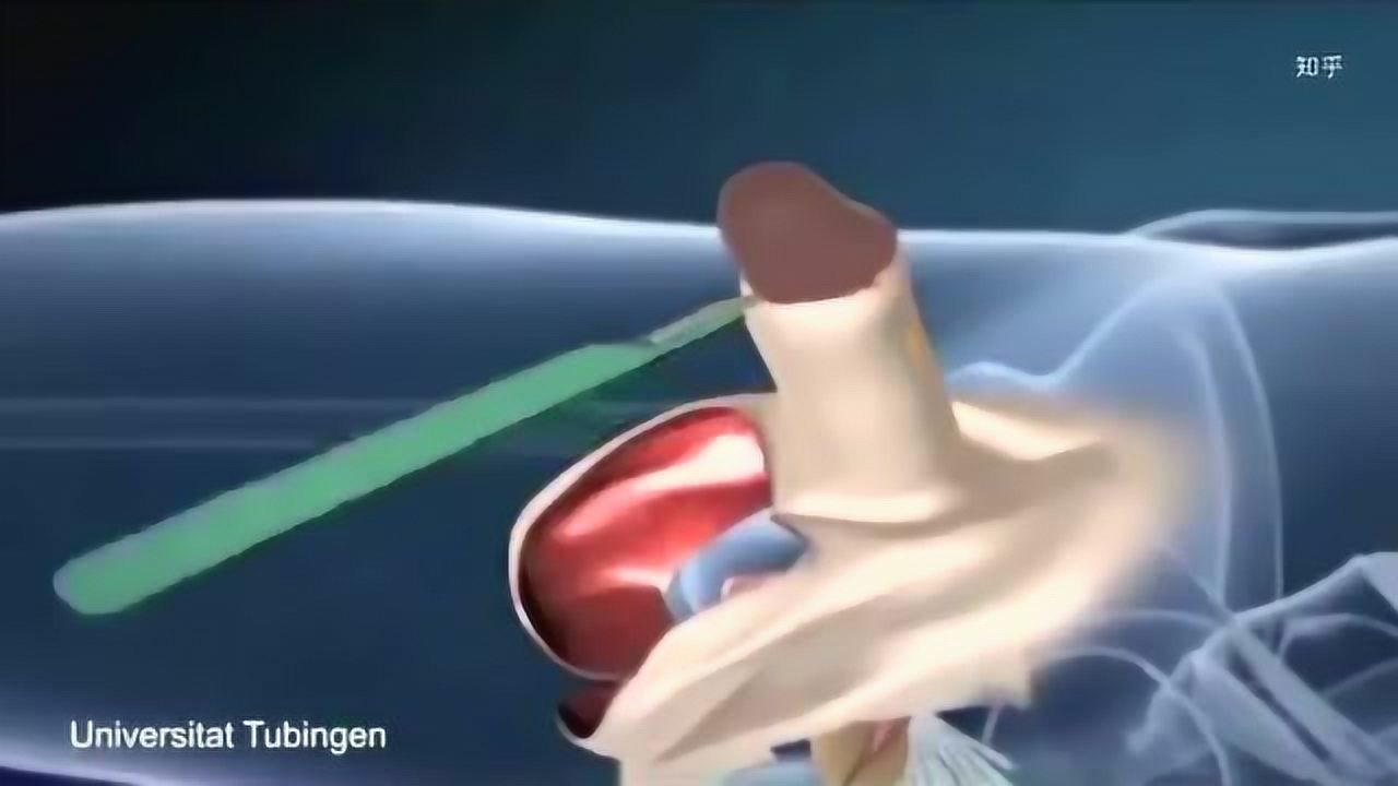3d演示:变性手术(男变女)_腾讯视频