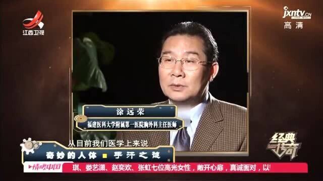 男子的手动不动就会狂出汗 专家分析 是排汗系统出了问题