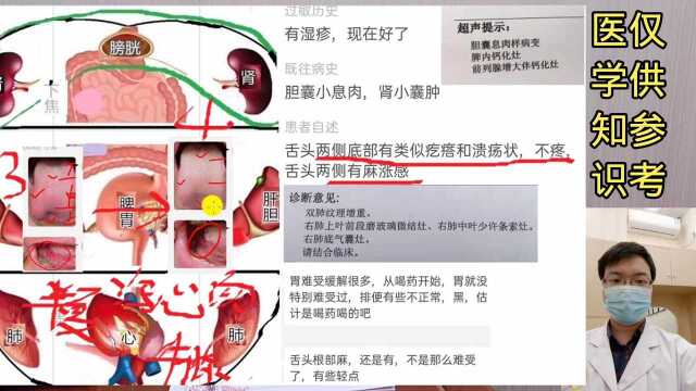 胃反酸 舌头溃疡 中医舌诊