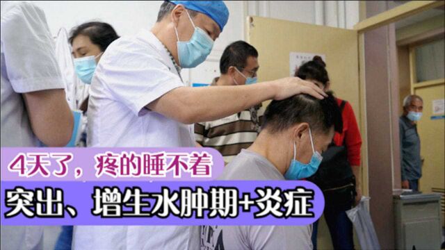 大叔椎间盘突出、增生、神经根水肿—手麻、颈椎坠痛,胳膊痛