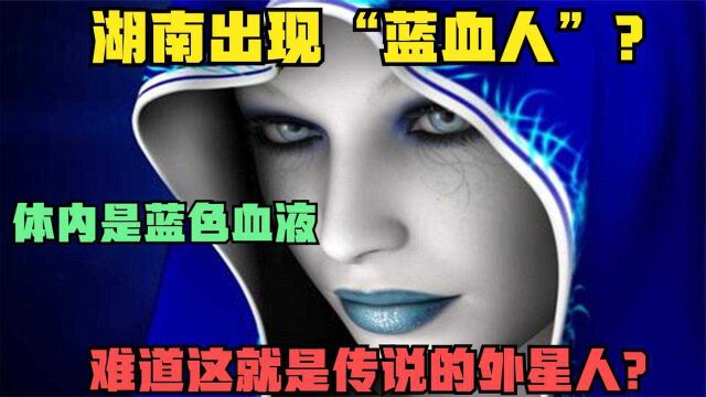 湖南出现“蓝血人”?体内是蓝色血液!难道这就是传说的外星人?