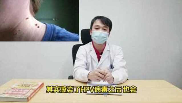 子宫“受伤”,身上会露出3个破绽,若你全有,最好去检查下HPV