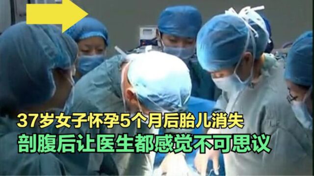 37岁女子怀孕5个月后,胎儿离奇消失,剖腹一看医生直呼医学奇迹