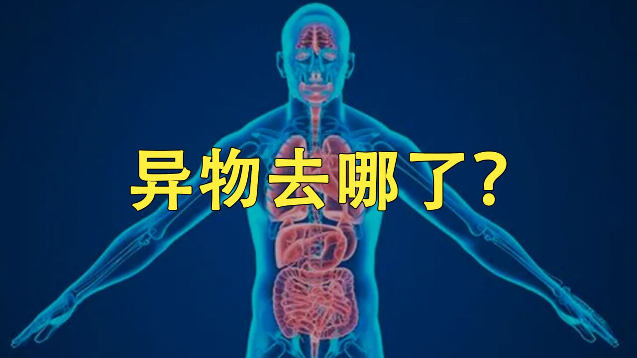 那些不小心进入身体的异物,去哪了?