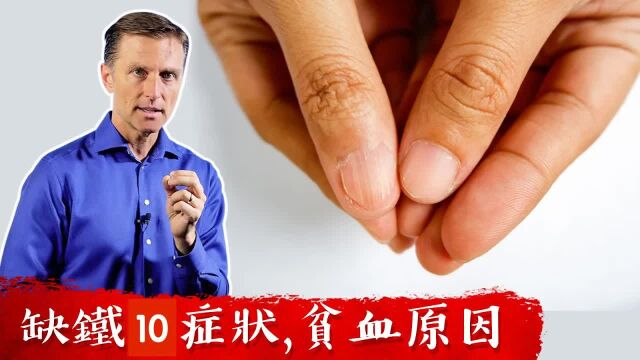 缺铁10症状,贫血原因,自然疗法,柏格医生 Dr Berg