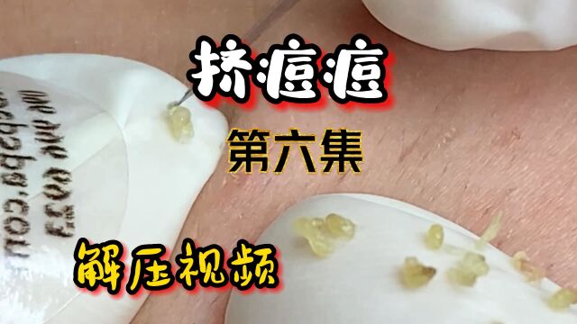 颗粒爆满,晶莹剔透,不可多得