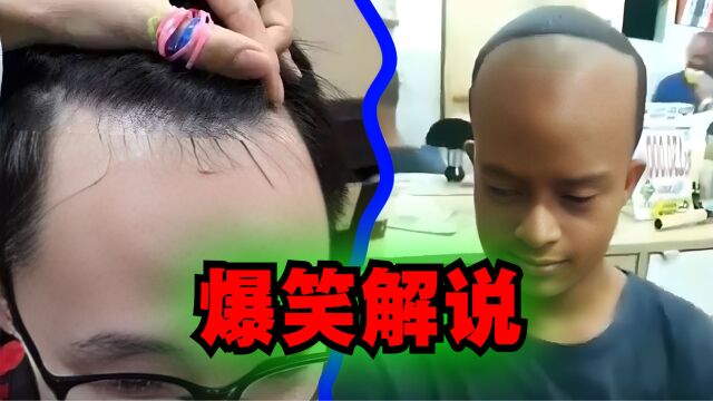 爆笑解说:听说发际线高的人更聪明,这是真的吗?