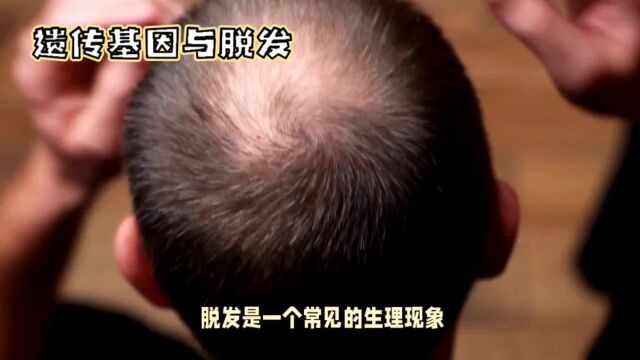 脱发基因会遗传到下一代吗,遗传学角度看脱发风险