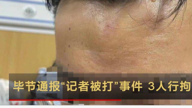 毕节通报“记者被打”事件:3人行拘