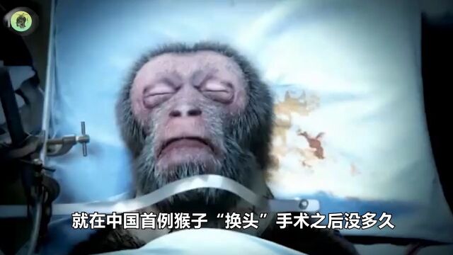 世界第一例“换头”手术实现了,人类什么时候可以随意“换头”?生命科学 3