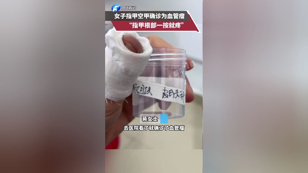 女子指甲空甲确诊为血管瘤“指甲根部一按就疼”