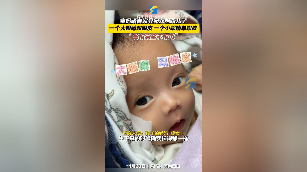 宝妈晒自家异卵双胞胎儿子,一个大眼睛双眼皮、一个小眼睛单眼皮