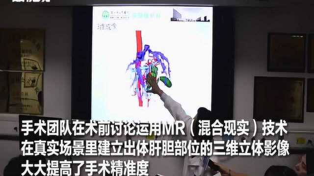 全球首台5G+MR+AR手术在深圳完成 虚拟现实交互上演医疗“骚操作”